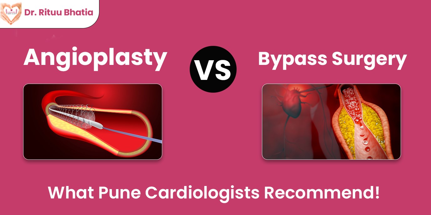 angioplasty-vs-bypass-surgery
