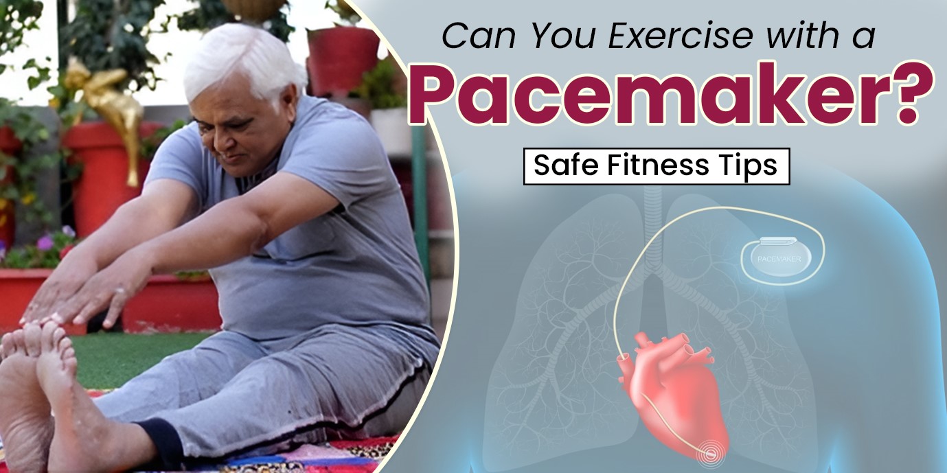 can-you-exercise-with-a-pacemaker-safe-fitness-tips