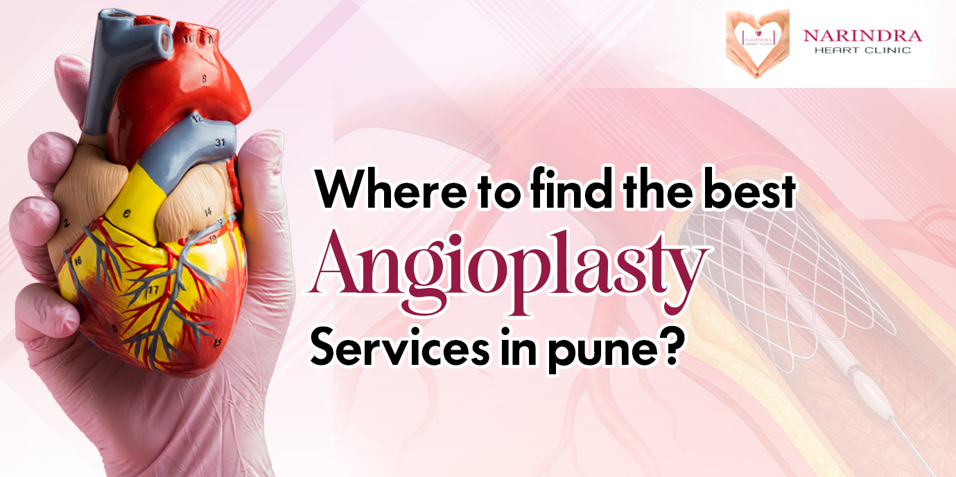 angioplasty